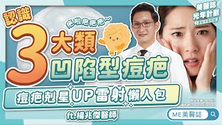 痘疤治療「怎變平」？UP雷射修復期要注意？3大類凹疤詳解！ft楊兆傑醫師【ME美醫誌】 [upl. by Liddle]