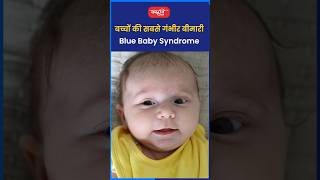 बच्चों को सबसे गंभीर बीमारी Blue baby syndromeriteshjaiswalsir science short viral sanskritiias [upl. by Kavanaugh]