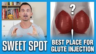 Best Place For Glute Injection  The Sweet Spot [upl. by Eelyah]