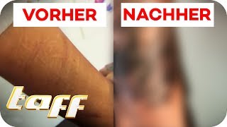 Cover Up für Narben vom Ritzen  taff  ProSieben [upl. by Eedebez]