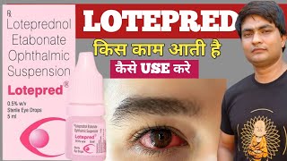 lotepred eye drop  lotepred eye drops  lotepred eye drops uses in hindi  lotepred eye drops uses [upl. by Battista]