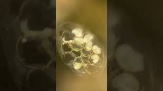 Ramshorn snail hatching SnailHatching AquariumSnails RamshornHatch SnailEggs AquariumLife [upl. by Burgener]