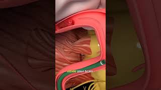 Thrombectomy 🫣 [upl. by Lodge199]