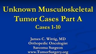 Orthopedic Oncology Course  Unknown Test Cases Part A Cases 110  Lecture 11 [upl. by Eerok817]