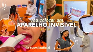 vou colocar aparelho INVISÍVEL✨ sousmile skan 3D… [upl. by Knoll822]