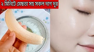 মাত্র ২ মিনিটে কলার সাহায্য মেছতা দাগছোপ উদাও😱😱 [upl. by Werdma635]