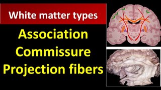 White Matter CNS  Association Commissure Projection fibers [upl. by Ajak]