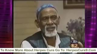 Dr Sebi On Herpes Cure  Natural Cure For Herpes By Dr Sebi [upl. by Annovoj]