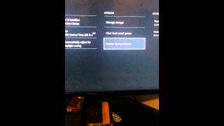 Xbox teredo IP address fix [upl. by Oreste285]