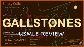 Gallstones Review for USMLE 13 [upl. by Acsisnarf32]