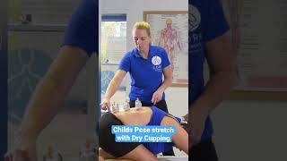 Clinical Dry Cupping and Child’s Pose Stretch [upl. by Adnamal]