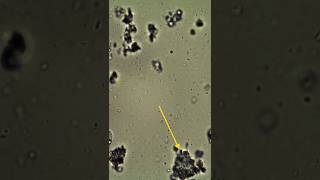 How Bacteria in dosa batter looks under microscope part2 [upl. by Cherian383]