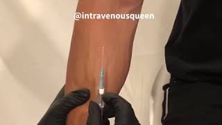 Prevent Veins From Blowing And Thumb Maneuver by Intravenous Queen [upl. by Nodnil]