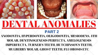 Developmental disturbances in teeth  Dental anomalies  Odontology notes  UGC NET Forensic science [upl. by Yhtir848]