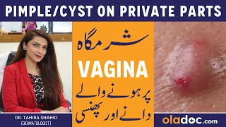 PIMPLE ON PRIVATE PARTS  Sharamgah Par Danay Ka Ilaj  Vaginal Cyst  Prevent Inner Thigh Pimples [upl. by Ayaladnot590]