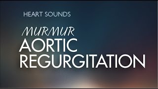 Aortic InsufficiencyRegurgitation murmur  With Murmur Sounds Audio [upl. by Shulins859]