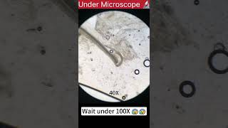 under microscope amoebaunder microscope chickenunder microscope skinshorts videos youtubeshorts [upl. by Bolen]