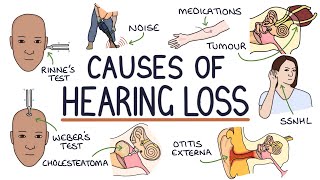 Understanding the Causes of Hearing Loss [upl. by Sophie]