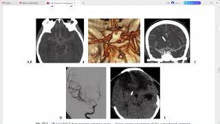 CASE BASED BRAIN IMAGING [upl. by Flss]