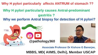 Why H pylori causes Antral predominant gastritis amp particularly affects antrum of stomach hpylori [upl. by Neleag451]