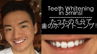 DIY Teeth Whitening in 5mins  たった５分で歯のホワイトニング！ [upl. by Aisek276]