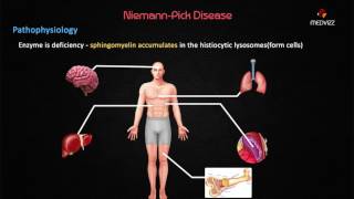 NiemannPick Disease  Case Based discussion  Usmle step 1 Biochemistry [upl. by Rusty68]