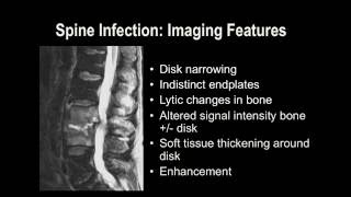 Understanding Basic MRI of the Spine [upl. by Ameerahs850]