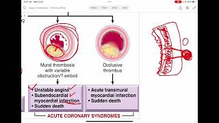 1 Ischemic Heart Disease [upl. by Yvor176]