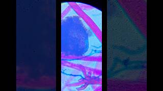 Rhizopus sp under microscope  Microbiology education shorts [upl. by Halyahs862]