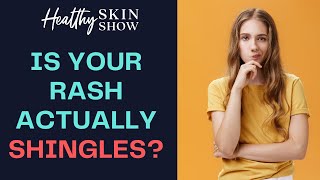 Is Your Rash Actually SHINGLES  Dr Mamina Turegano [upl. by Seldon]