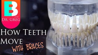 BRACES EXPLAINED How Teeth Move  Braces Work [upl. by Cristina507]