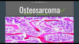 Osteosarcoma GeneralMorphology SubtypesClinical features [upl. by Cynara]