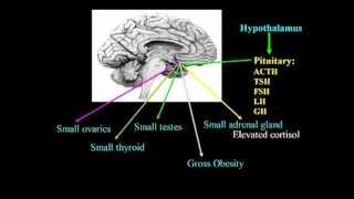 Excitotoxins Neurotoxins amp Human Neurological Disease Lecture  Dr Russell Blaylock [upl. by Greggs]