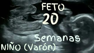 ❤️ SEMANA 20 DE EMBARAZO🤰 ❤️ ⏩ EMBARAZO SEMANA A SEMANA ⏩ Desarrollo y Evolución del Bebé 👶🏻 [upl. by Ayotnom733]