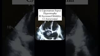 Interatrial Septum Quiz echocardiography [upl. by Aimas28]