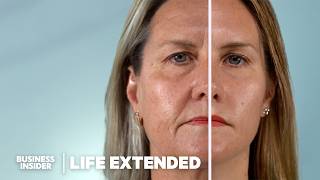 Scientists Are Closer Than Ever To Reverse Aging How Does It Work  Life Extended [upl. by Dielle464]