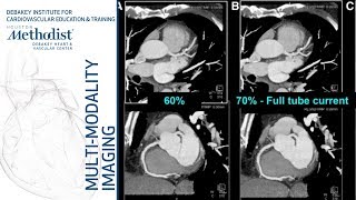 Cardiac CT Current Technology amp Principles Faisal Nabi MD FACC September 11 2018 [upl. by Ainat169]