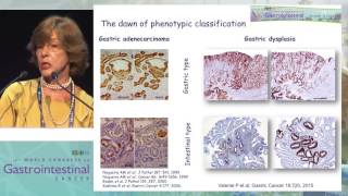 Gastric carcinogenesis of gastric cancer through the eyes of a pathologist [upl. by Incrocci]