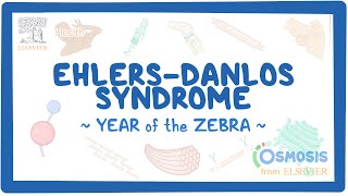 EhlersDanlos syndrome Year of the Zebra [upl. by Kcyred]