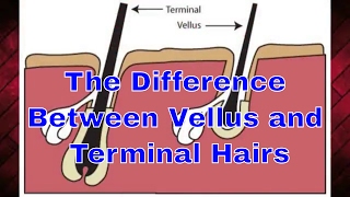 The Difference Between Vellus and Terminal Hairs  TheBeardnecessities  Ep 33 [upl. by Ulita285]