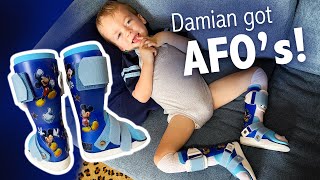 How They Made Custom AFOs ankle braces for My 2YearOld [upl. by Nairde]