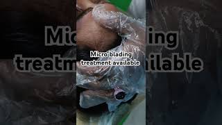 micro blading treatment [upl. by Marj]