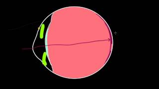 Common disorders of the eye and NCLEX style practice questions [upl. by Tonnie]