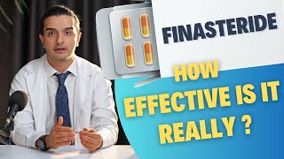 Finasteride  How Effective Is It Really   Dr Ghorbani Explains [upl. by Howell]