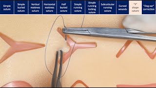 Suturing techniques [upl. by Nahshu145]