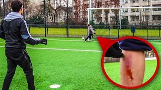 FUßBALL CHALLENGE ENDET BLUTIG nicht nachmachen [upl. by Darryn]