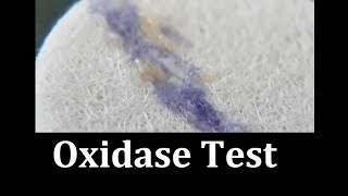 Oxidase test Protocol [upl. by Eicyac]