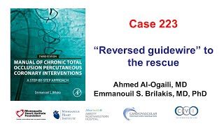 Case 223 Manual of CTO PCI  Reversed guidewire to the rescue [upl. by Rma]