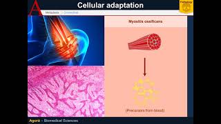 Cellular Pathology  Metaplasia [upl. by Corenda]