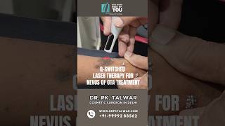 QSwitched Treatment for Nevus Of OTA Procedure  Nevus Of OTA Treatment in Delhi  Dr PK Talwar [upl. by Nollek]